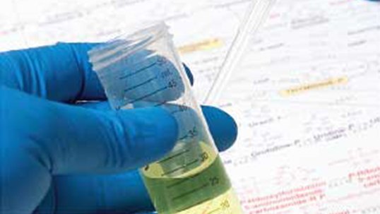 Labordiagnostik, radiologische Untersuchungen Labordiagnostik, radiologische Untersuchungen